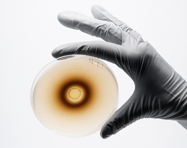 Understanding Metabolic Complexity